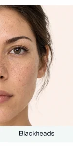 Skincare Portrait_ Blackhead Texture