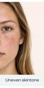 Uneven Skin Tone Beauty Card